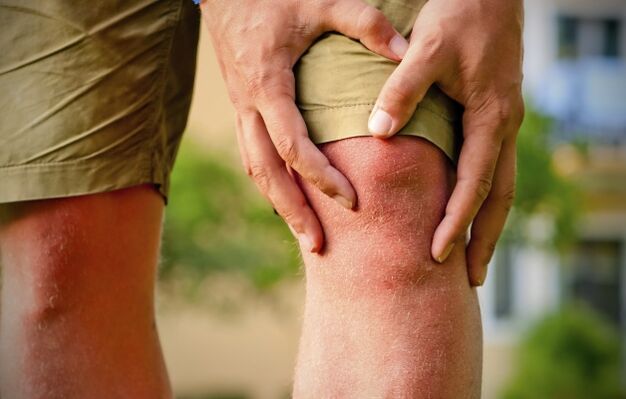 Imagen clínica de la osteoartritis