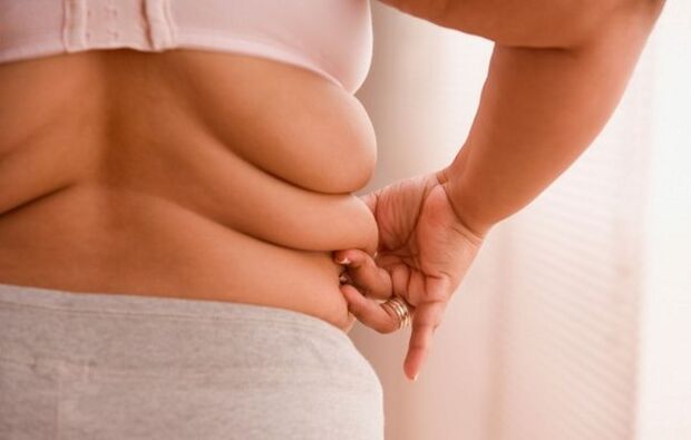Obesidad, causa de osteocondrosis cervical en mujeres menores de 40 años