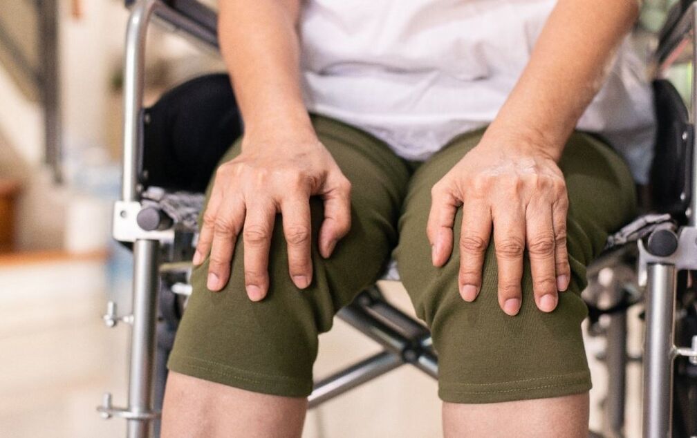 Un paciente con osteoartritis de las articulaciones de la rodilla. 