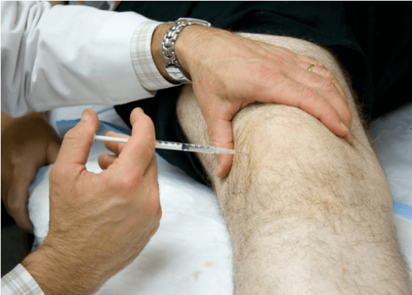 Administración intrakarticular de analgésicos en dolor severo